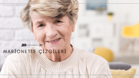 Marionette Çizgileri