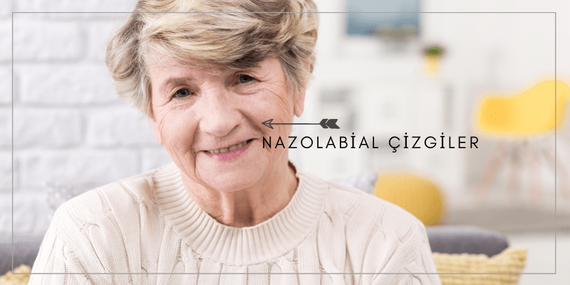 Nazolabial Çizgiler