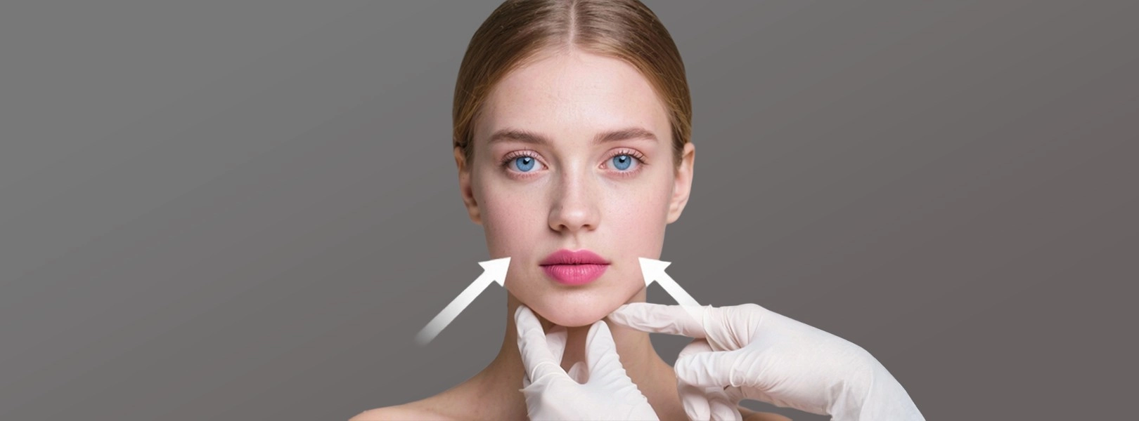 Buccal Fat Removal (Hollywood Cheek/Bichatectomy)