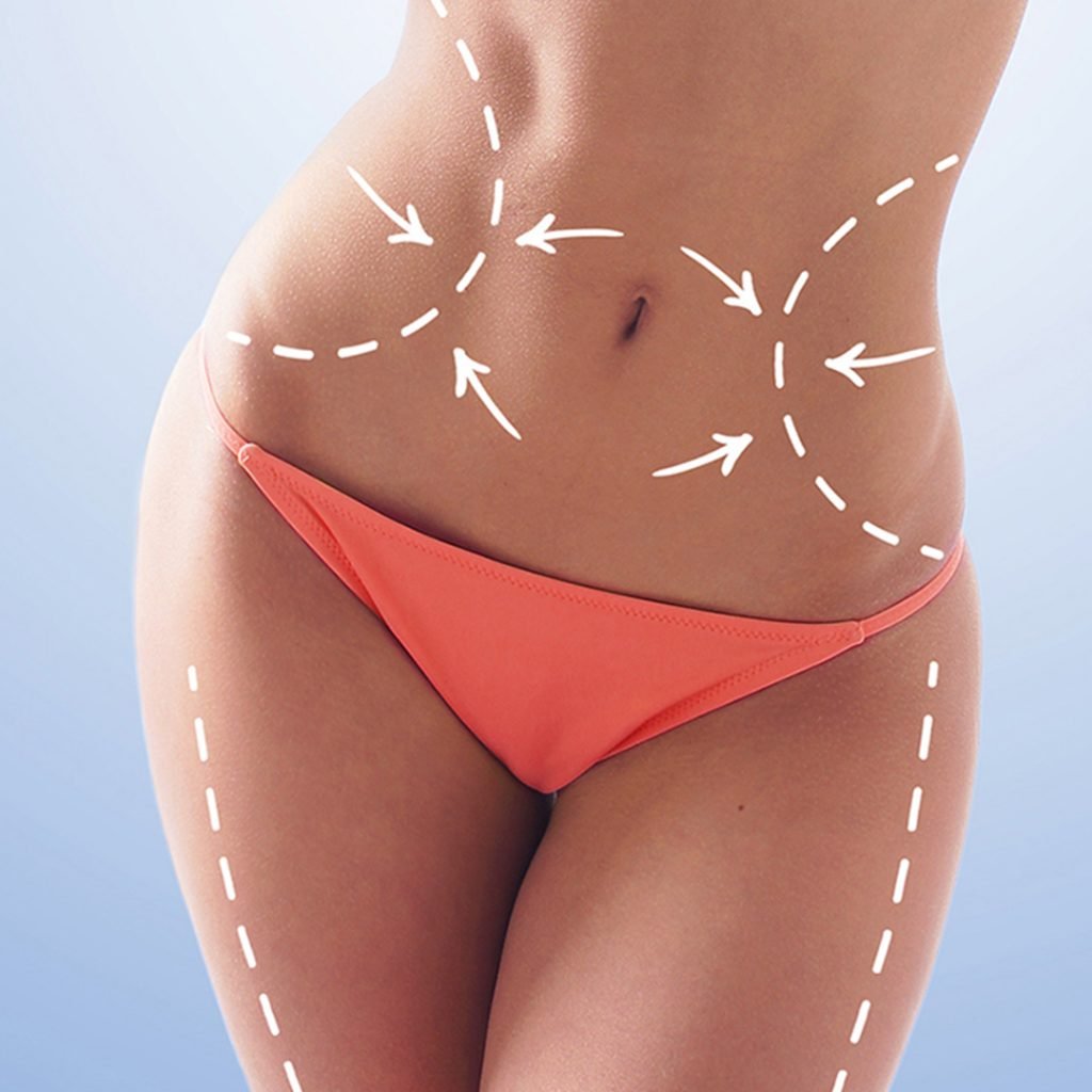 Vücut Şekillendirme Operasyonları