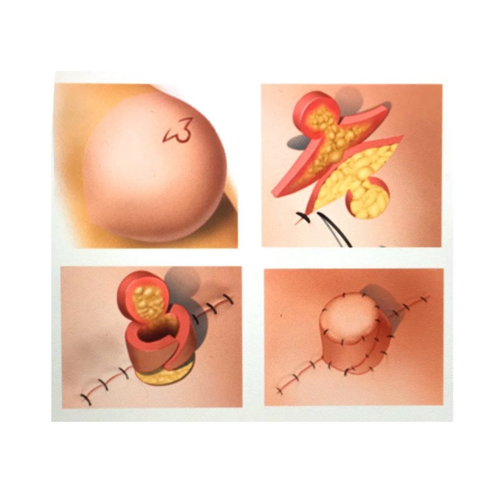 Meme Ucu Estetiğinde Merak Edilenler